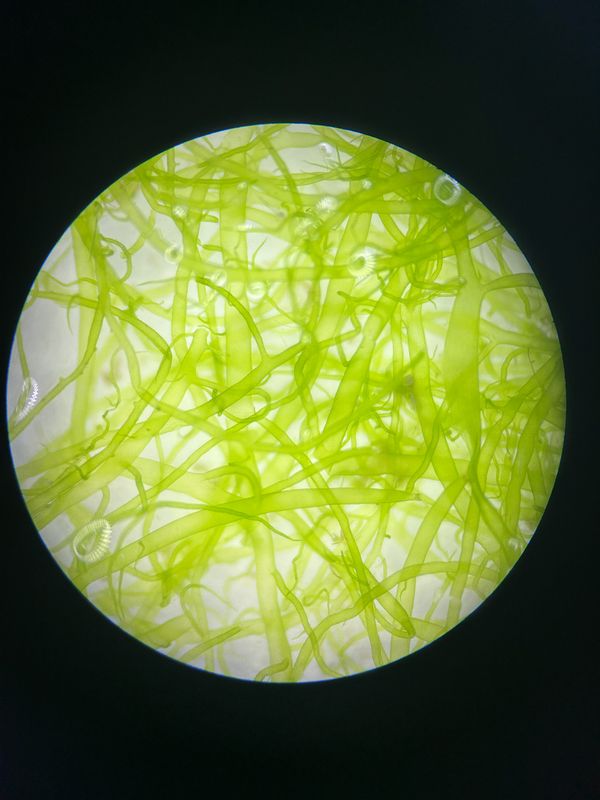 Suolilevänäyte mikroskoopin alla